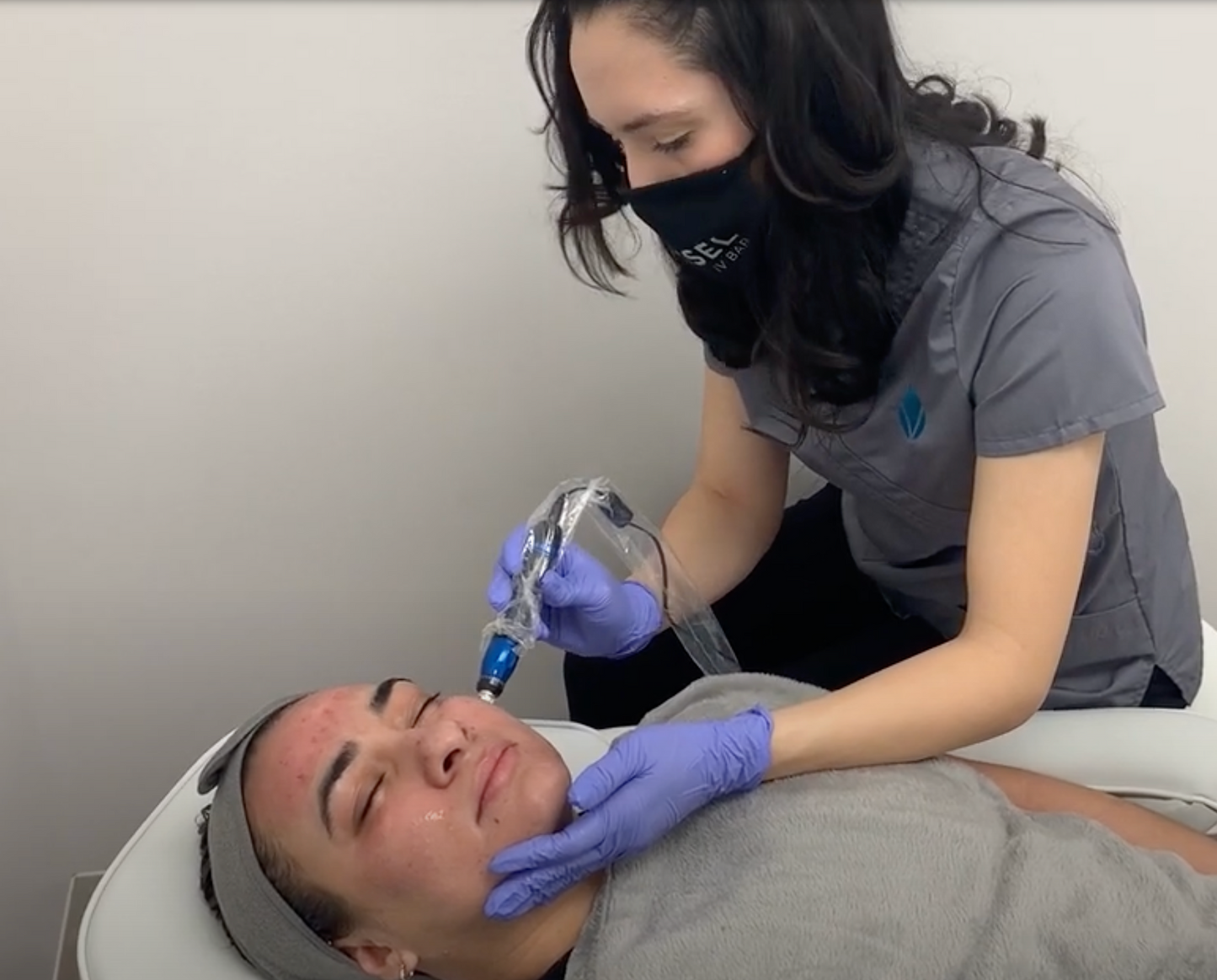 DEALS THAT SLEIGH - Exosome Microneedling Package (3 treatments) $1600