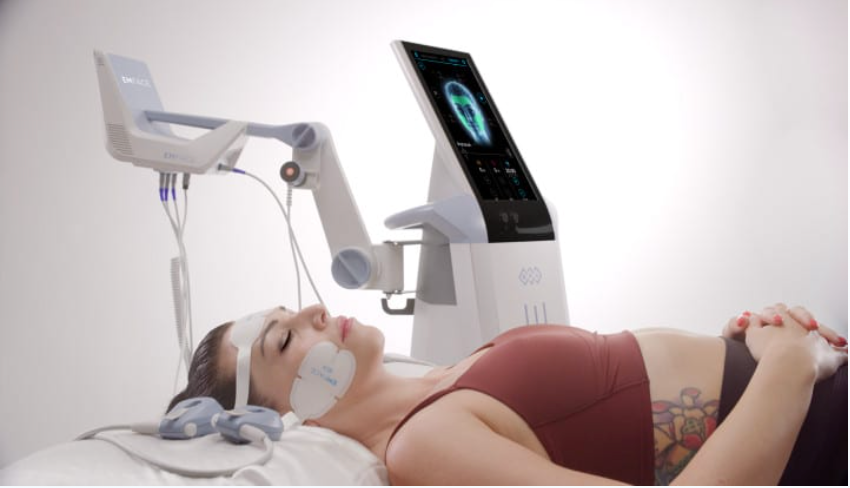 DEALS THAT SLEIGH - EMFACE facial rejuvenation package (4 treatments) $1600 per area (reg. $2400)