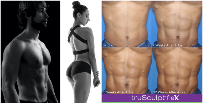 BLACK FRIDAY SPECIAL - $1199 Body Sculpting Combo (fat loss/muscle toning) (reg. $1699)